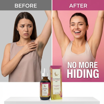 Cyperus Rotundus Oil for Hair Reduction