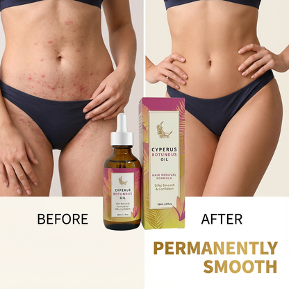 Cyperus Rotundus Oil for Hair Reduction